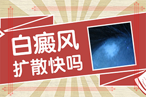 臉上出現(xiàn)白色斑塊是什么情況“斑形成的原因有哪些”什么原因會誘發(fā)