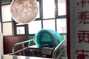 新鄉外陰白斑能治好嗎