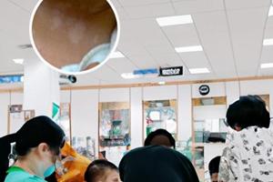 小孩臉上白斑什么回事圖片大全