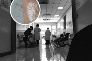 祛白軟膏看白點怎么用