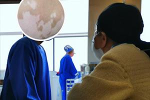 他克莫司軟膏與鹵米松哪個治療白癜風效果好