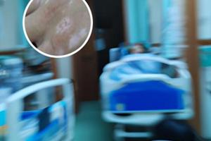 308要做多少次黑色素才講出來