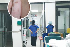 白癜風會突然出現嗎