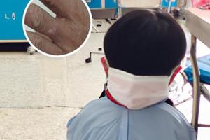 白癜風光療多久才有效果